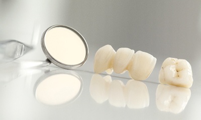 dental crown and bridge sitting next to a dental mirror