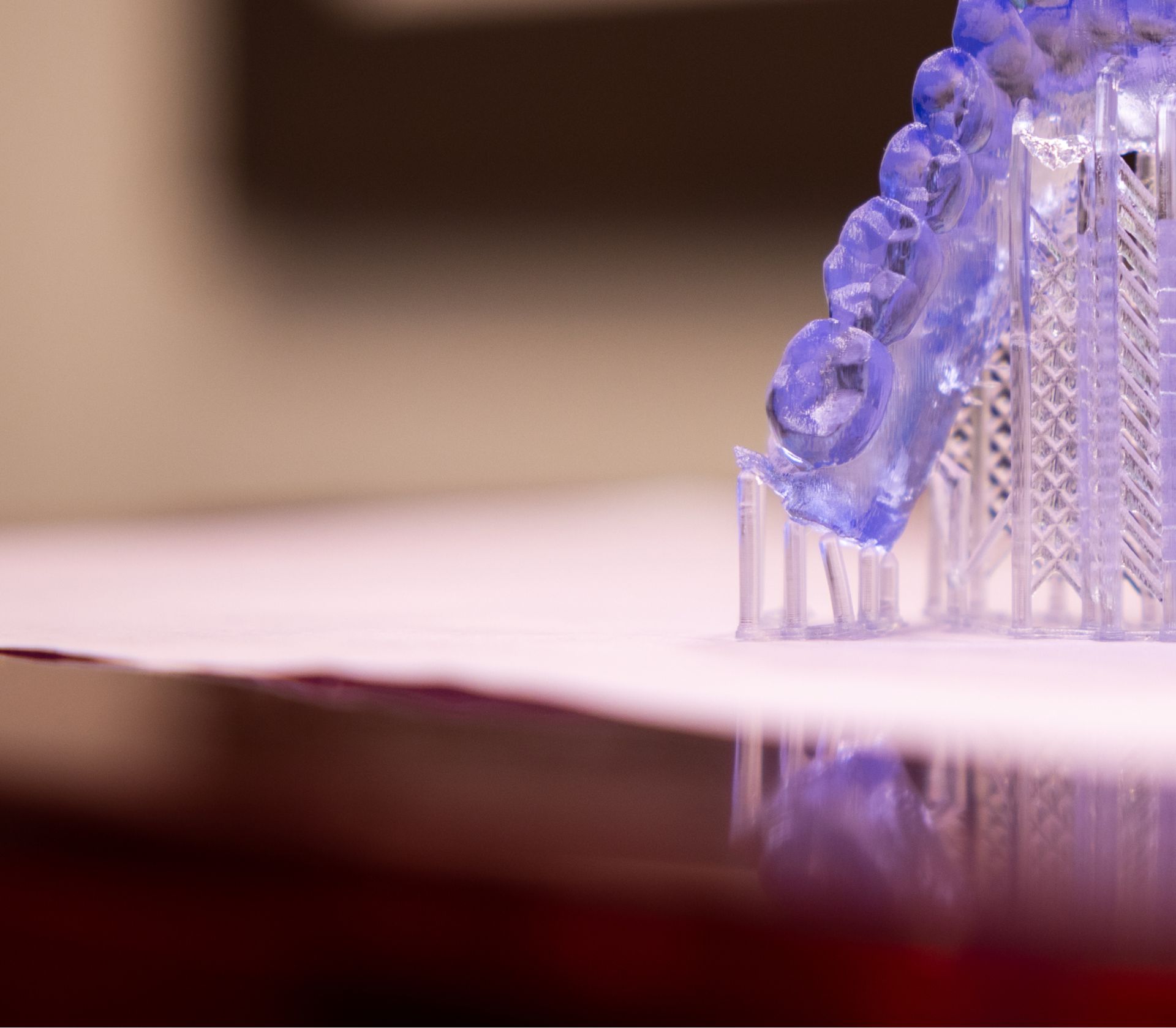 All-on-X full arch implant smile — Dolan Dental patient